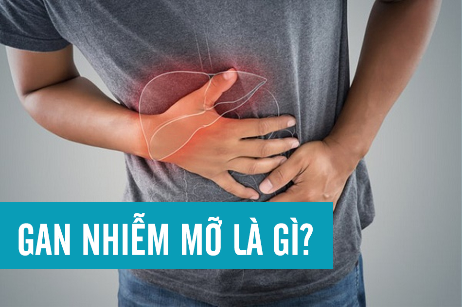 Bệnh gan nhiễm mỡ là gì?