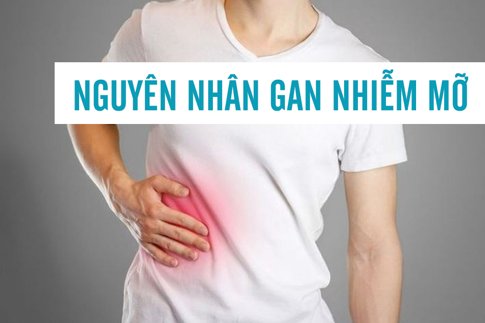 Nguyên nhân dẫn đến việc gan nhiễm mỡ 