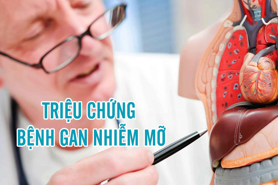 Triệu chứng gan nhiễm mỡ 